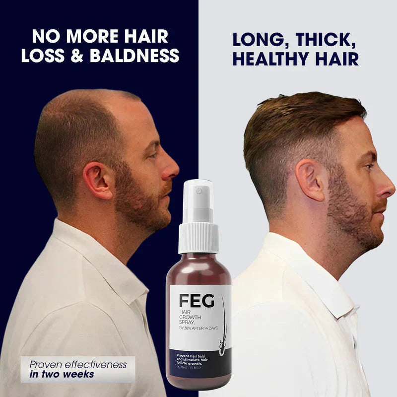 FEGPlus Official 100% Natural Hair Growth Spray - (Buy 1 Get 2 Free🔥)