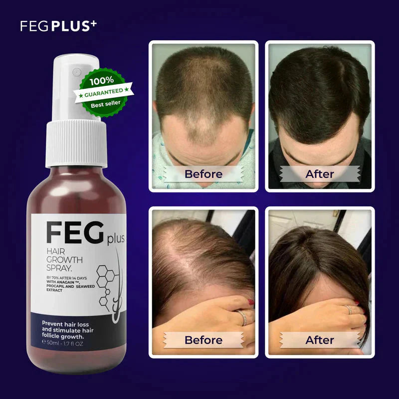 FEGPlus Official 100% Natural Hair Growth Spray - (Buy 1 Get 2 Free🔥)